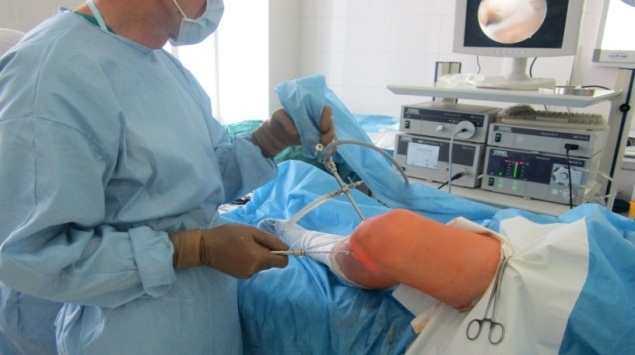 Артроскопия мениска коленного сустава