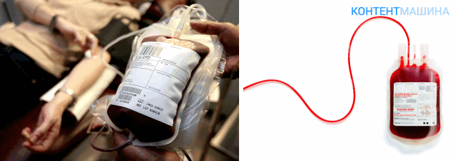 гемотрансфузия (переливание крови) - как проводится процедура