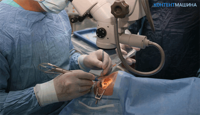 применяемое оборудование при операции на глаукоме